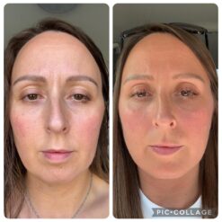 Alternative view of BalanceOil+